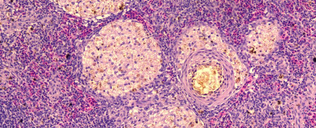 Spleen 1024x414